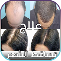 ﻿علاج تساقط الشعر عند الرجال