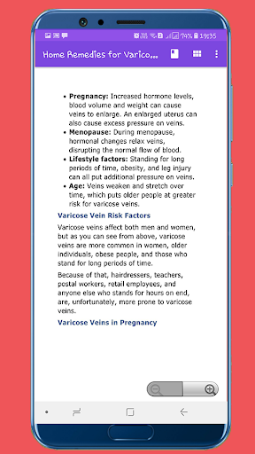 Home Remedies for Varicose Veins