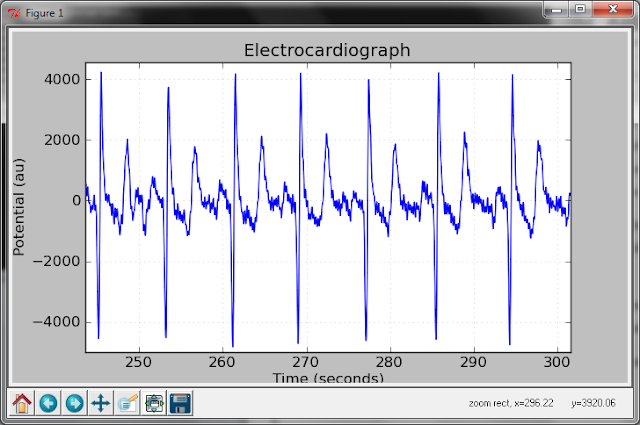 homemade sound card ecg circuit waveform