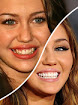 20 Famosos que se arreglaron los dientes