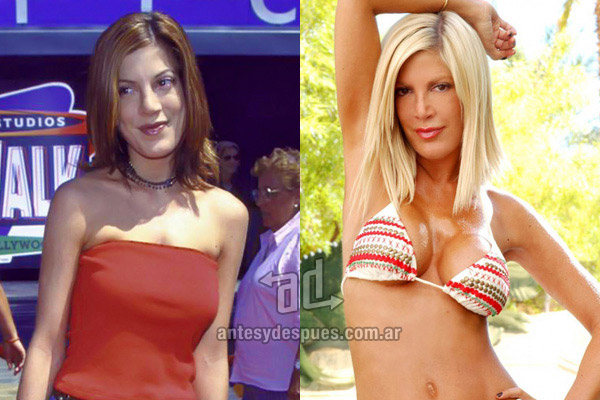 Los pechos operados de Tori Spelling