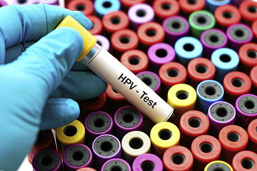 Human papillomavirus (HPV) is the sexually transmitted infection that plays a role in increasing the risk and causing most cervical cancer cases.