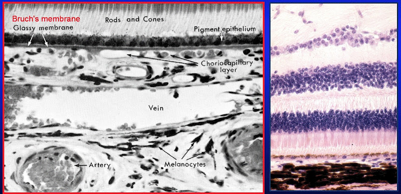 choroid.jpg
