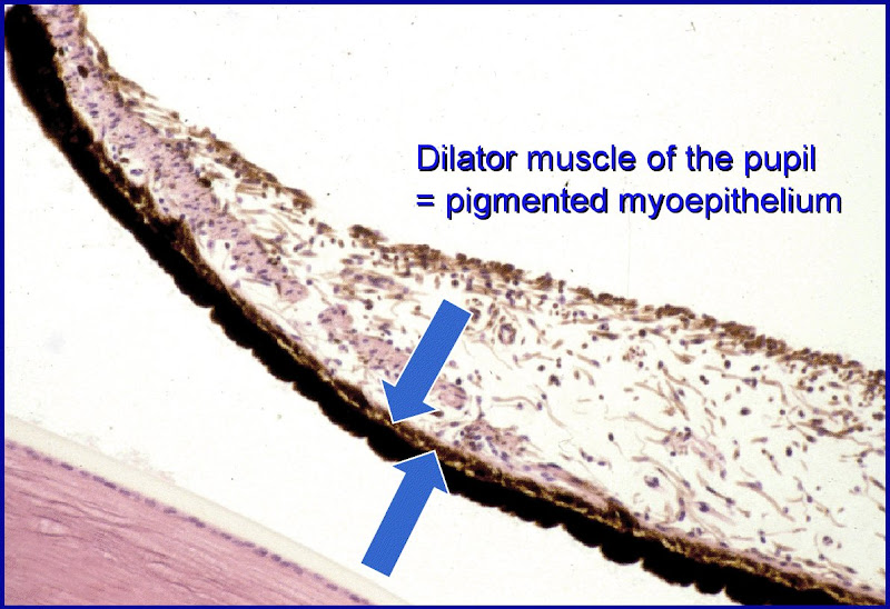 pigmented_myoepithelium.jpg