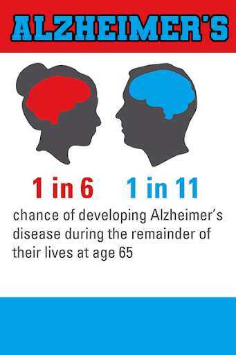 Alzheimers