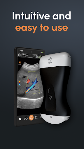 Screenshot Clarius Ultrasound