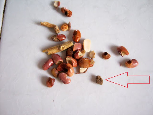 stone and bad beans