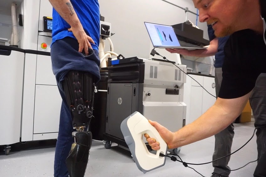 Custom fit, accurate prosthetics are made possible, and made faster, thanks to 3D scanning