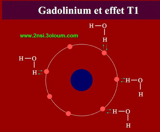 L_IRM_pour_les_nuls 14