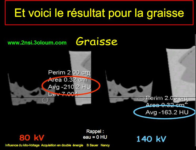 Le rayonnement X 6