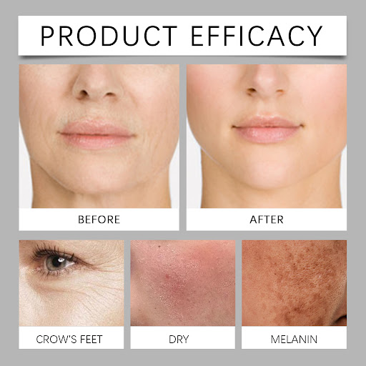 Title 8, Vitamin C Retinol Cream for Firming Skin. Reduc...