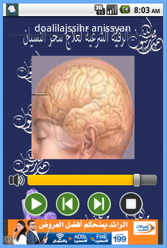 الرقية الشرعيةلعلاج سحرالنسيان