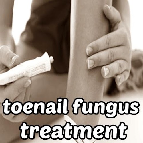 Android application Toenail Fungus Treatment screenshort