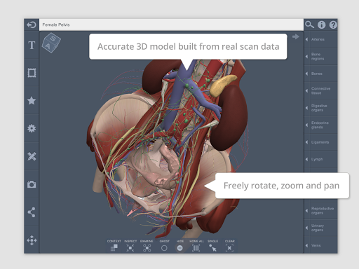 Female Pelvis: 3D RT - Sub