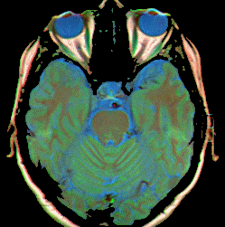 Neuro-ophthalmology Blog