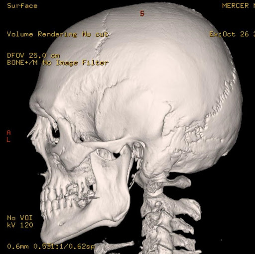 The Mariners Hotel, Lyme Regis (updated prices 2024)