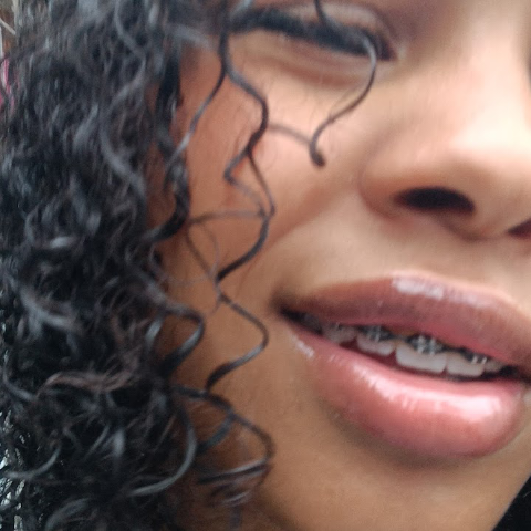 Dentista em Perus - Dra. Thaisa Lima | Clinico Geral, Estética e Pediatria — foto 3