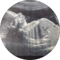 Avatar de Lily-Rose.