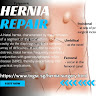 hernia repair