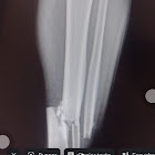 Uživatel: Tacho Rojas