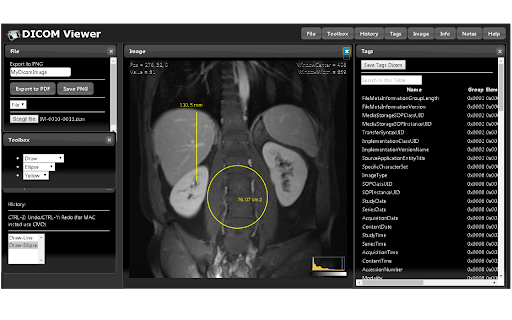 Dicom Image Viewer