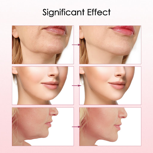 Title 9, V15 Gear Heating Model Facial Lifting and Tight...