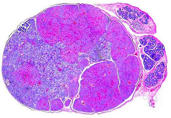 Testis of newborn pacarana with numerous (red) nodules of interstitial cell proliferation.