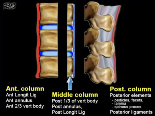 Divisão da coluna vertebral em três colunas de Denis. 
Fonte: Radiologyassistant.nl 