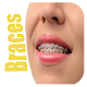 Download Braces Editor For PC Windows and Mac 1.2.v7a