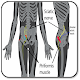 Piriformis syndrome Download on Windows