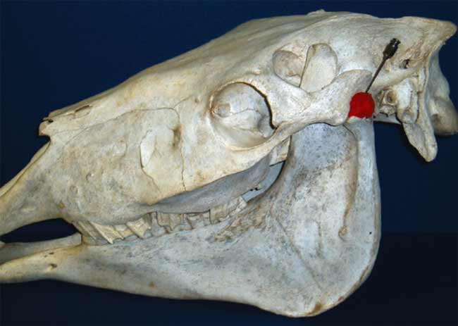 For centesis of the temporomandibular joint, a 20-ga, 1.5 in needle is inserted in a rostral ventral direction