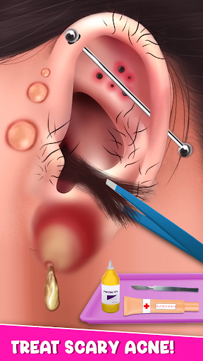 Screenshot Piercing Game: Ear Wax removal