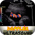 Basic Principles of Doppler Ultrasound1.0