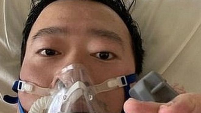 Dr Li posted a picture of himself on social media from his hospital bed.