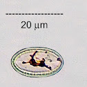 Epilithic Diatom