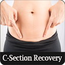 تنزيل C-Section Recovery التثبيت أحدث APK تنزيل