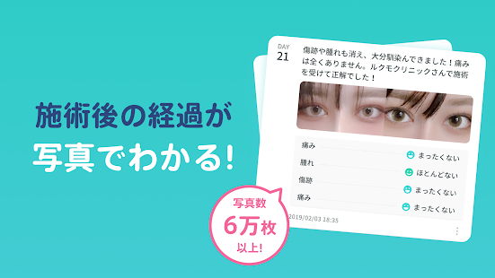 ルクモ（Lucmo）美容整形の写真口コミ・お得な整形予約アプリ(圖3)-速報App