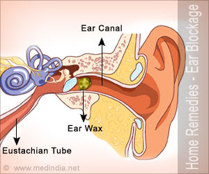 Home Remedies for Ear Blockage