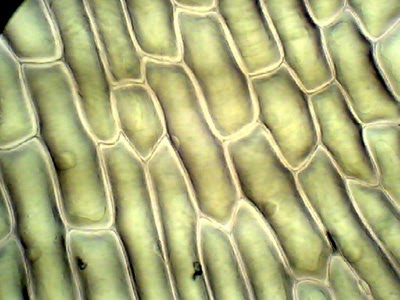 Plant Cell Under Microscope 40X Labeled : 1 - Chloroplast and cell wall animal cell: