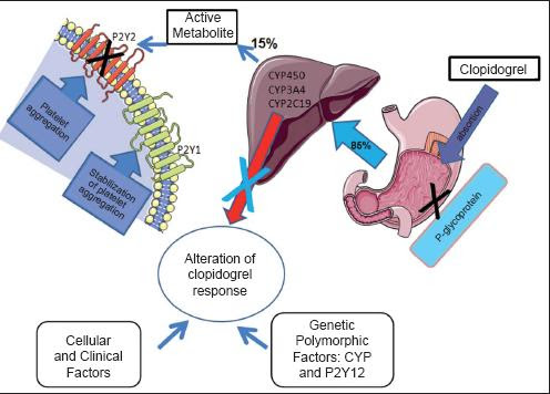 Proton Pump Inhibitors And Clopidogrel Evidence Of A Pharmacological Interaction Of Great Clinical Impact