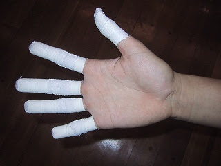手のテーピング