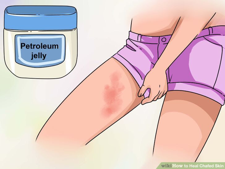 Heal Chafed Skin Step 3 Version 3.jpg