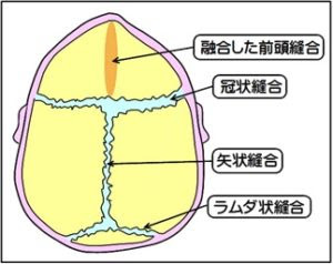 斜頭症 Plagiocephaly と頭蓋骨早期癒合症 Craniosynostosis シドニー日本人会 Japanese Society Of Sydney Inc