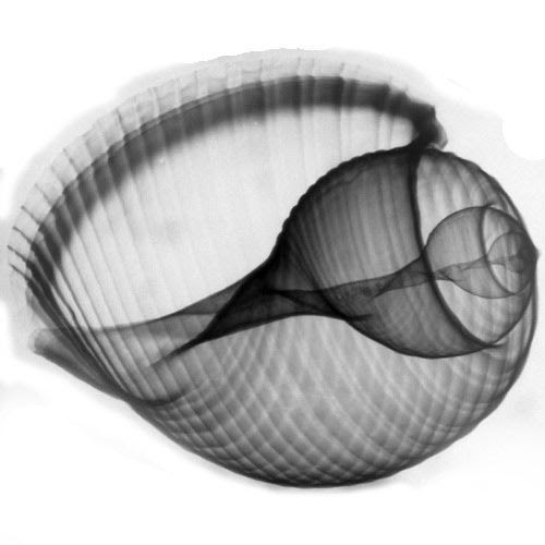 life with x-ray (59 pict)