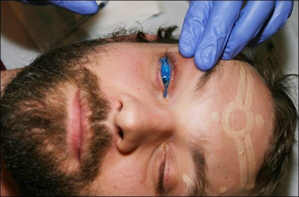Yeah, you read that right, an eyeball tattoo. The end result was a blue eye, 