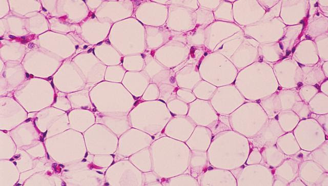 胖子的福音 纳米颗粒高科技减肥能粉碎脂肪