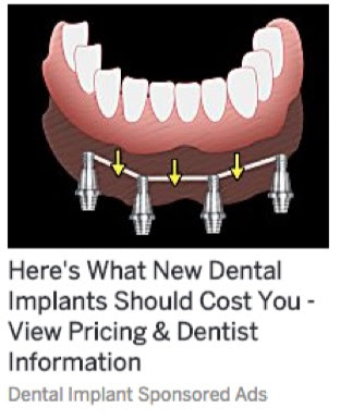dental-implants-clickbait-ad