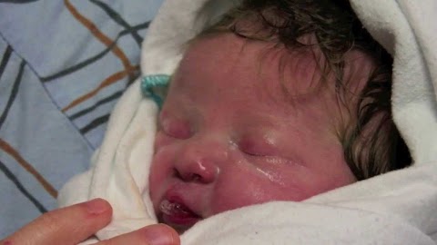 prader-willi syndrome
