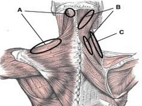 Sharp pain in back of neck