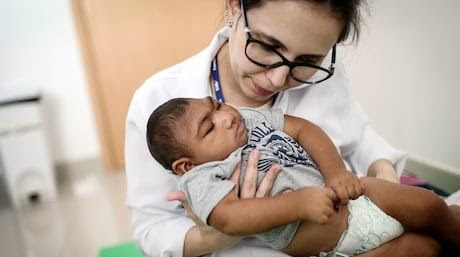 Zika microcephaly